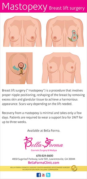 Breast Lift, Mastopexy