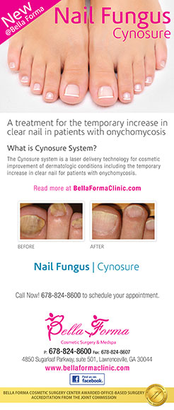 Nail Fungus – Cynosure